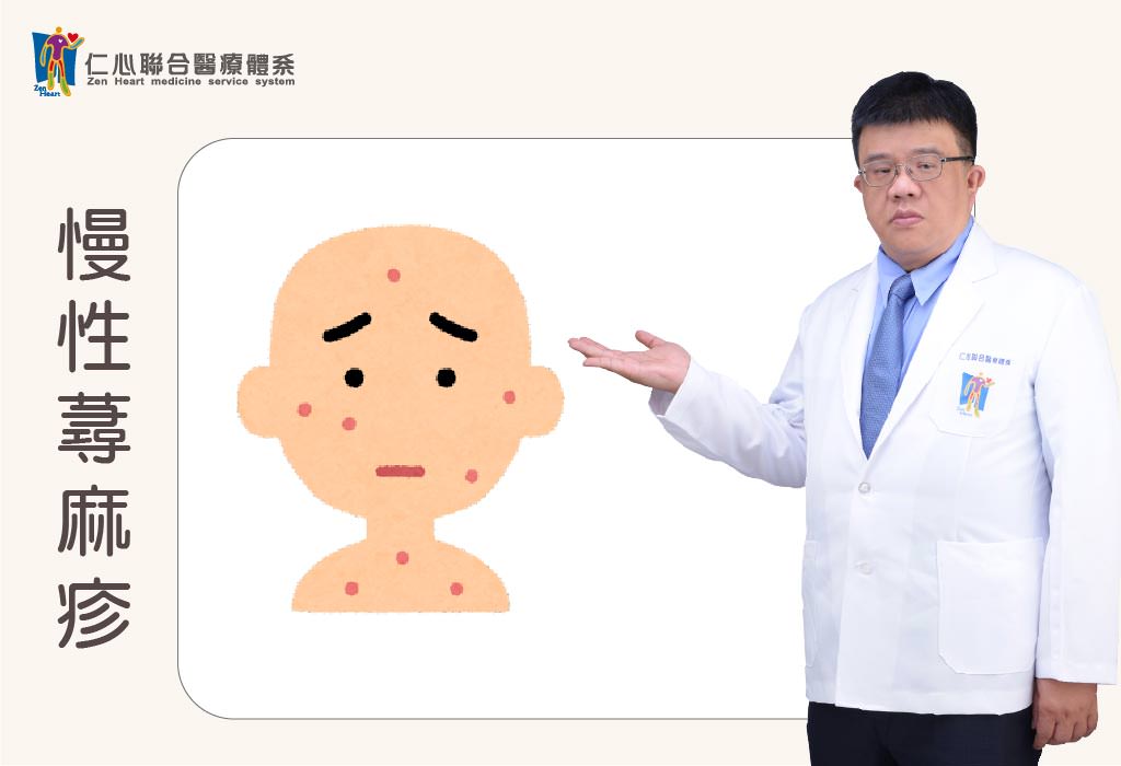 慢性蕁麻疹